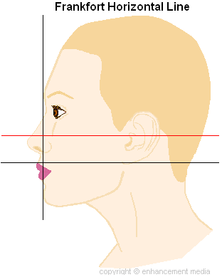 ideal nose diagram side